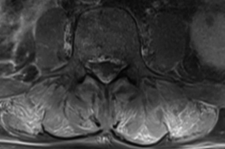 FIG 2.