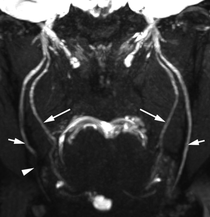 FIG 16.