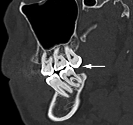 FIG 21.