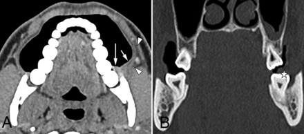 FIG 3.