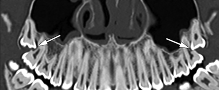 FIG 4.