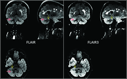 FIG 2.