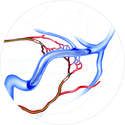 FIG 2.