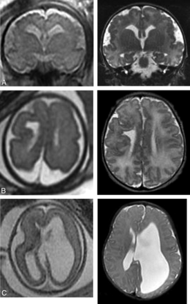 FIG 1.