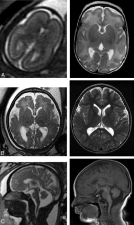 FIG 3.