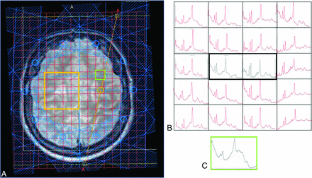 FIG 2.