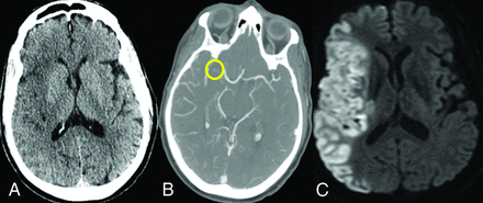 FIG 3.