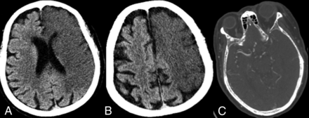 FIG 5.