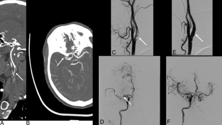 FIG 1.