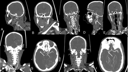 FIG 2.