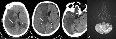 FIG 3.