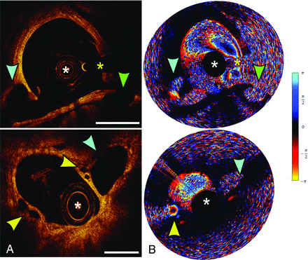 FIG 3.