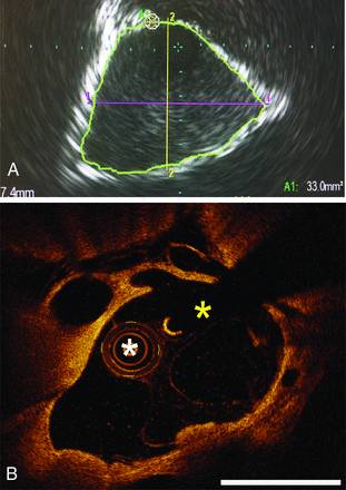 FIG 6.