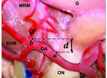 FIG 1.