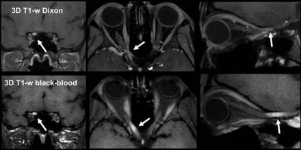 FIG 2.