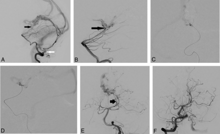 FIG 3.