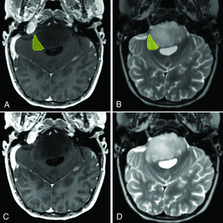 FIG 2.