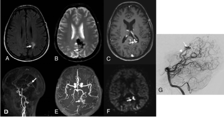 Fig 1.