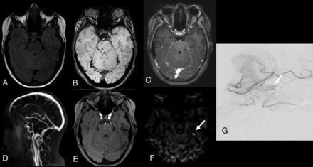 Fig 4.