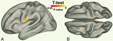 Fig 2.