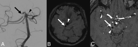 Fig 1.