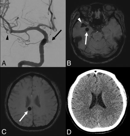 Fig 2.