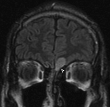 Fig 6.