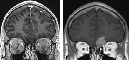 Fig 7.