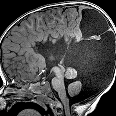 Fig 3.