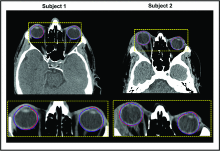 Fig 4.