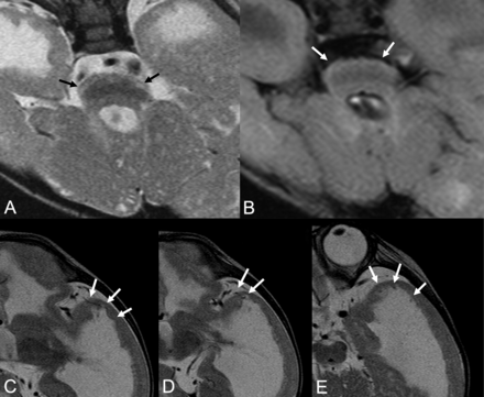 Fig 2.