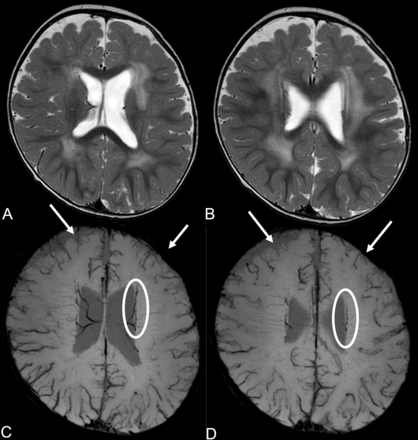 Fig 3.