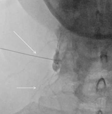 Fig 8.