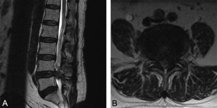 Fig 2.