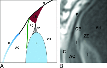 Fig 10.