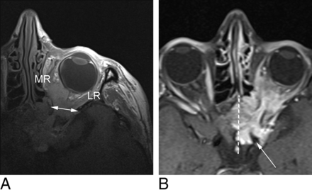 Fig 2.