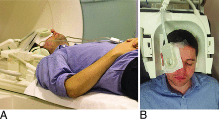 Fig 3.