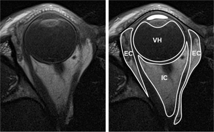 Fig 6.