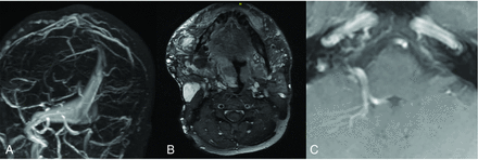 FIG 2.