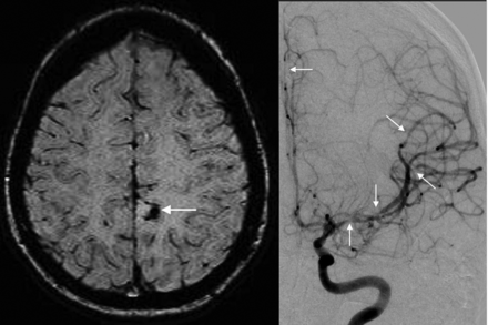 Fig 1.