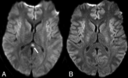Fig 11.
