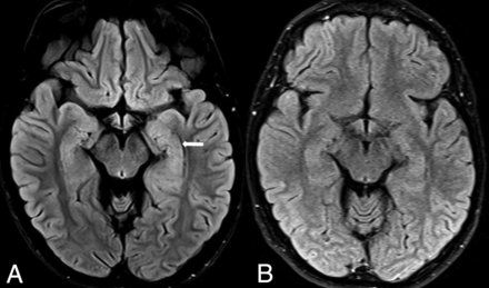 Fig 13.