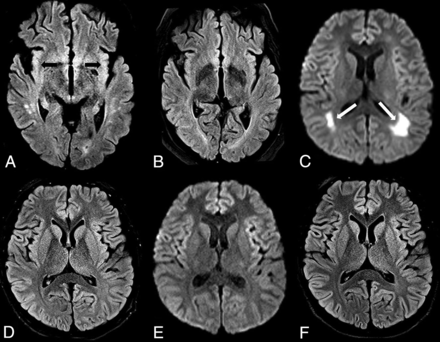 Fig 15.