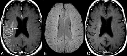 Fig 17.