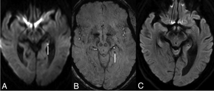 Fig 2.