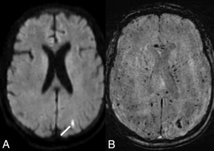 Fig 3.