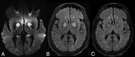 Fig 8.