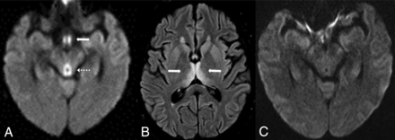 Fig 9.