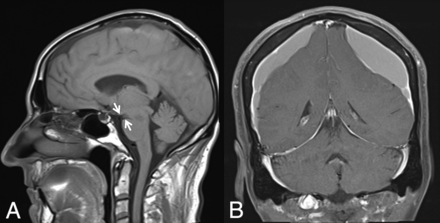 Fig 3.