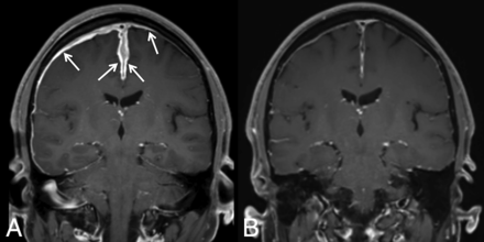 Fig 4.